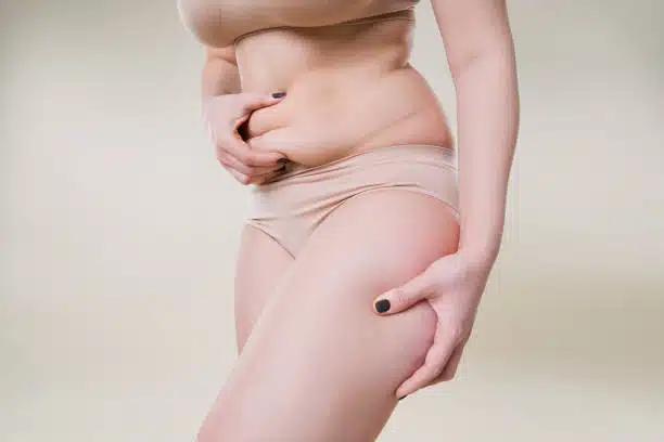 Image default